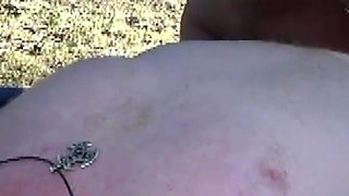 Nurses and the Injured Chopper