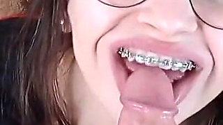 Please Cum on My Braces Dirty Talking Teen Blowjob