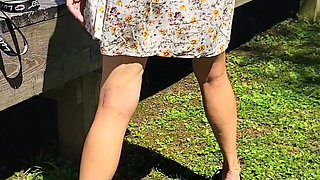 Park Minidress Tease