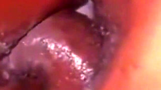 Deep Anal Penetration: Too Much for Me