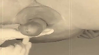 A Nurse in White Gloves Waxes a Guy